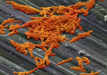 Chroboplodné baktérie a zárodky